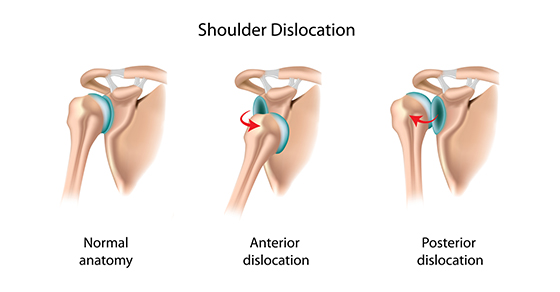 shoulder injury