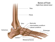 Ankle Stress Fracture Treatment 