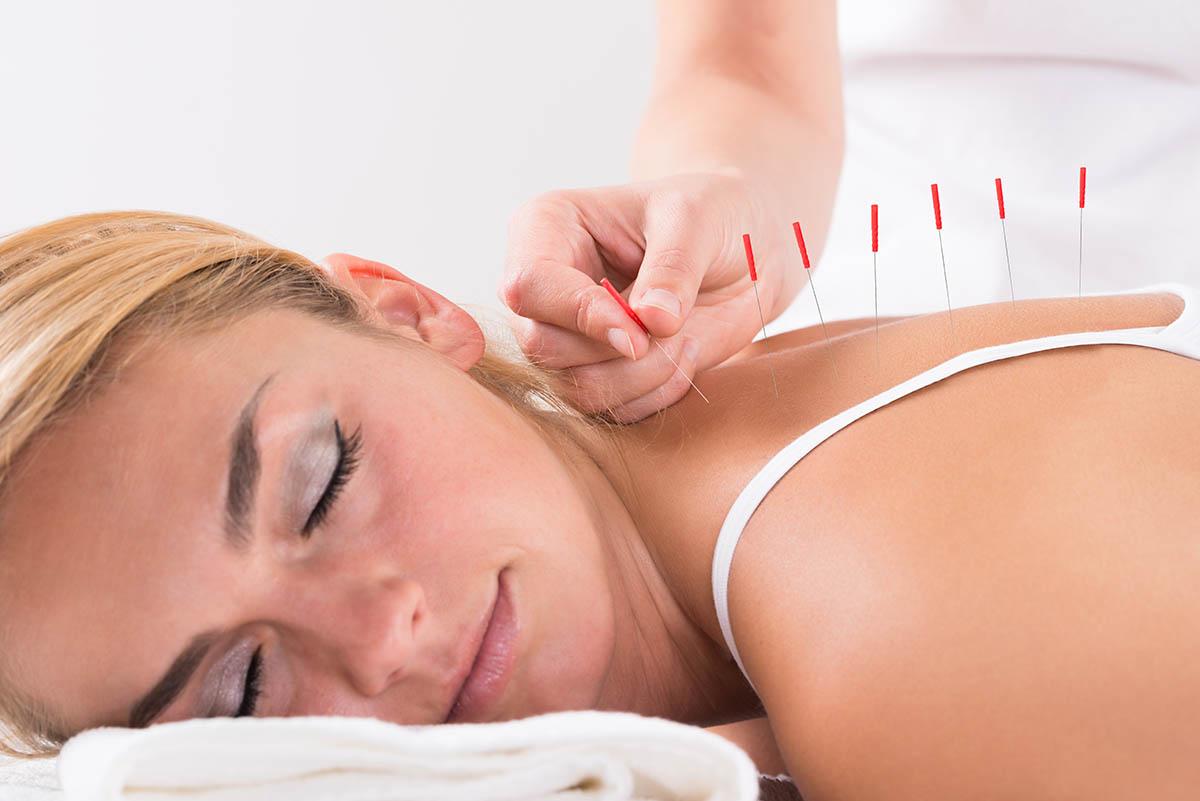 Acupuncture: Neck pain