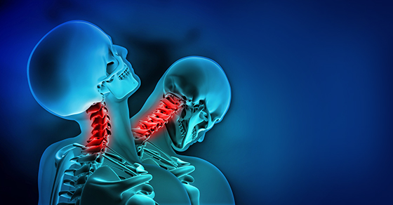 Whiplash Injuries