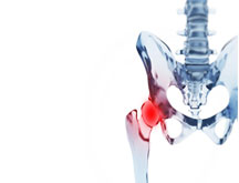 Physiotherapy: total Hip Replacement