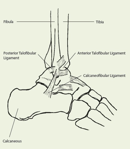 Acute Ankle Sprains