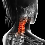 Physiotherapy for Neck Pain