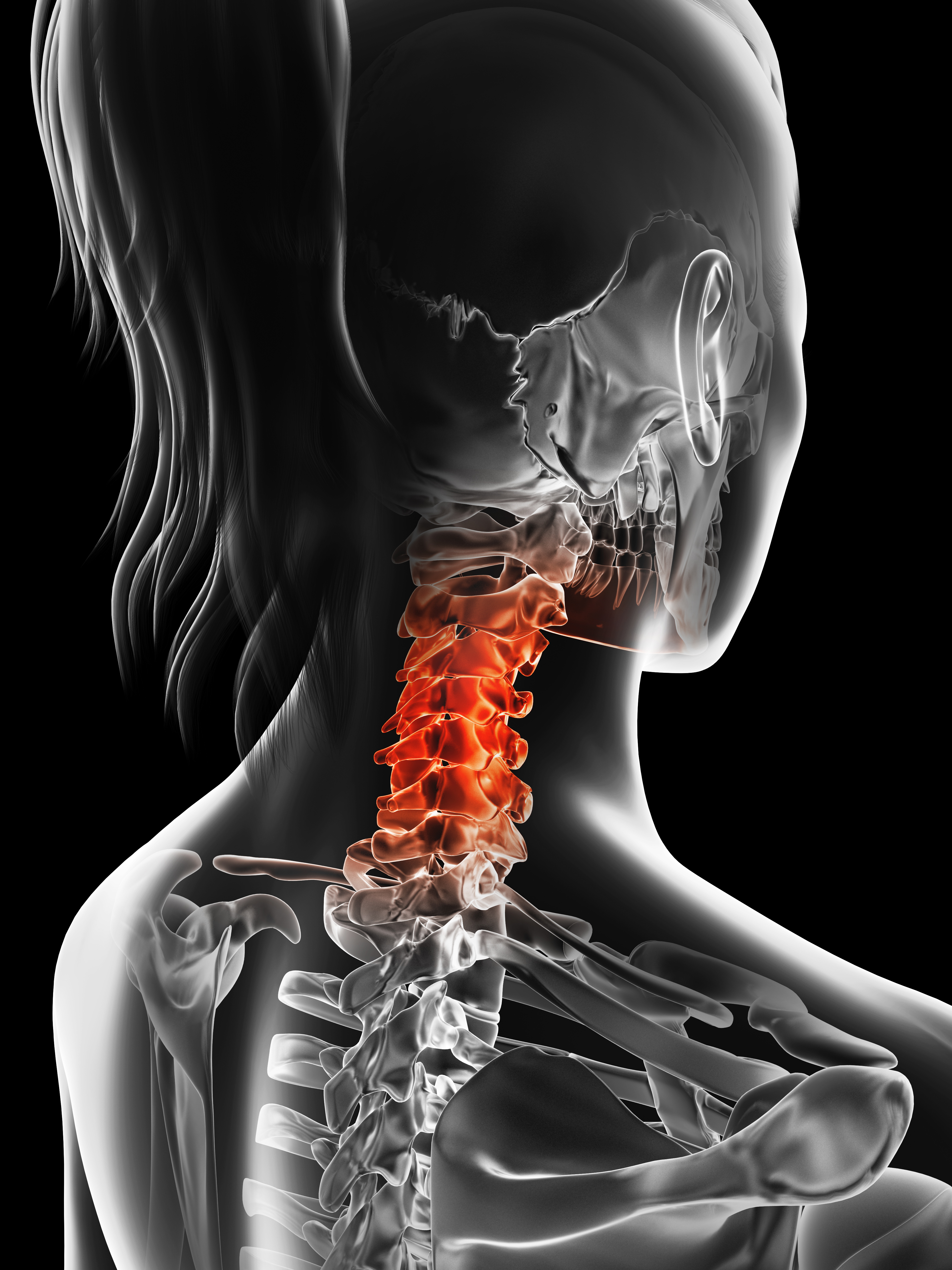 Physiotherapy for Neck Pain