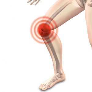 Managing knee pain