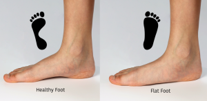 Orthotics 