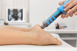 Shockwave therapy applied to the heel for plantar fasciitis
