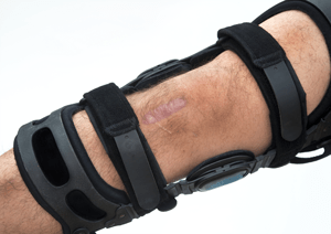 ACL Reconstruction Repair Surgery