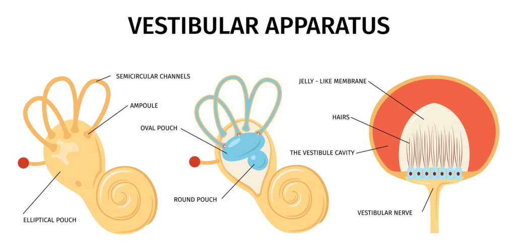 Anatomy of the vestibular apparatus showing the semicircular canals and the hair cells where the crystals usually attach