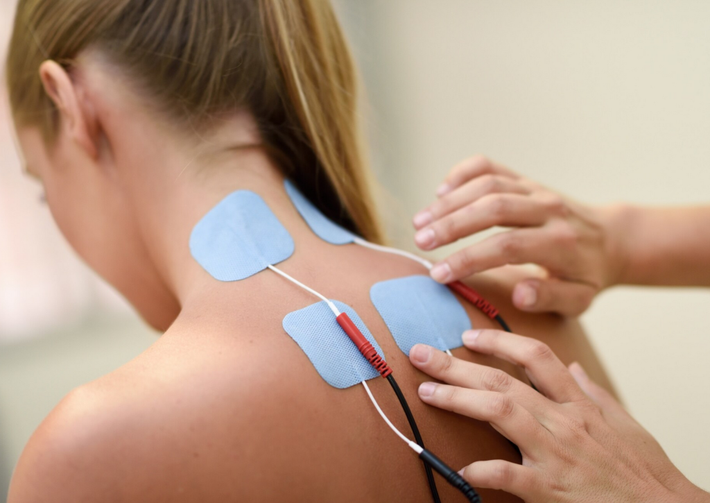 Image of an electrotherapy setup, showing 4 electrodes on a woman's neck and upper back 