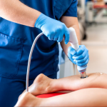 Shockwave Therapy on the Calf